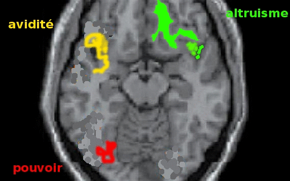scanner représentant un cerveau envahi par l'avidité et la soif du pouvoir